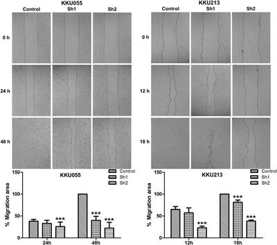Targeting Fatty Acid Synthase Modulates Metabolic Pathways and Inhibits Cholangiocarcinoma Cell Progression